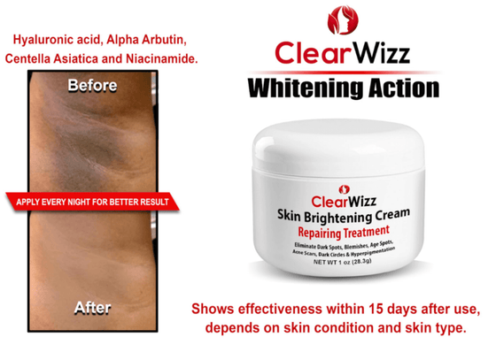 ClearWizz Skin Brightening Cream 1 oz