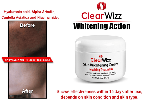 ClearWizz Skin brightening Cream 2 oz