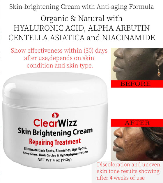 ClearWizz Skin Brightening Cream 1 oz