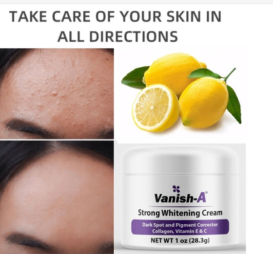 Vanish-A Strong whitening Cream 4 oz