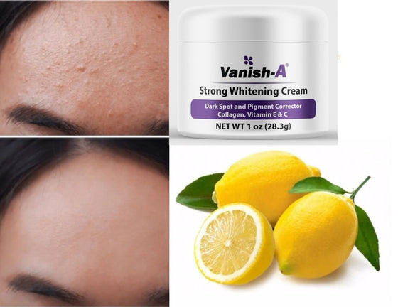 Vanish-A Strong Brightening Cream -2 oz