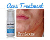 Pimple Stopper Acne Serum 1 .oz