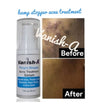 Pimple Stopper Acne Serum 1 .oz