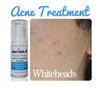 Pimple Stopper Acne Serum 1 .oz