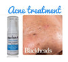 Pimple Stopper Acne Serum 1 .oz