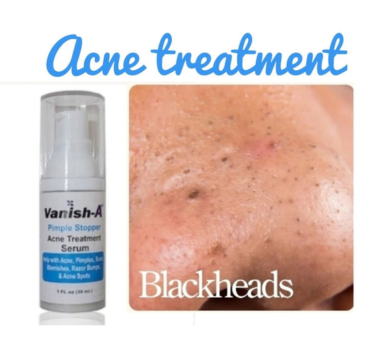 Pimple Stopper Acne Serum 1 .oz