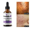 Vanish-A whitening serum - GoodBrands USA 