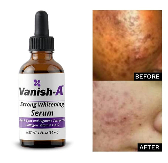 Vanish-A whitening serum - GoodBrands USA 