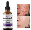 Vanish-A whitening serum - GoodBrands USA 