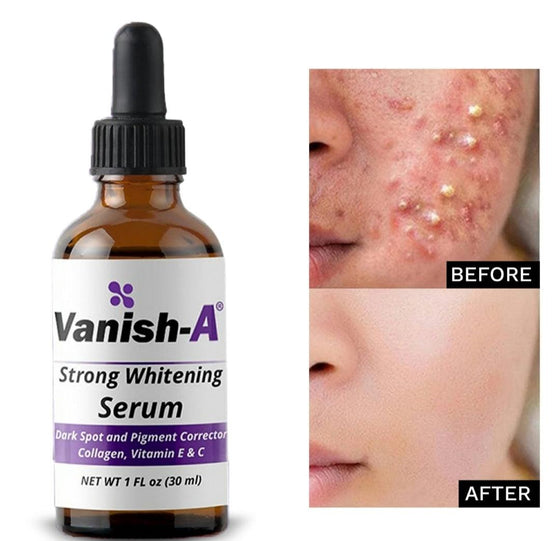 Vanish-A whitening serum - GoodBrands USA 