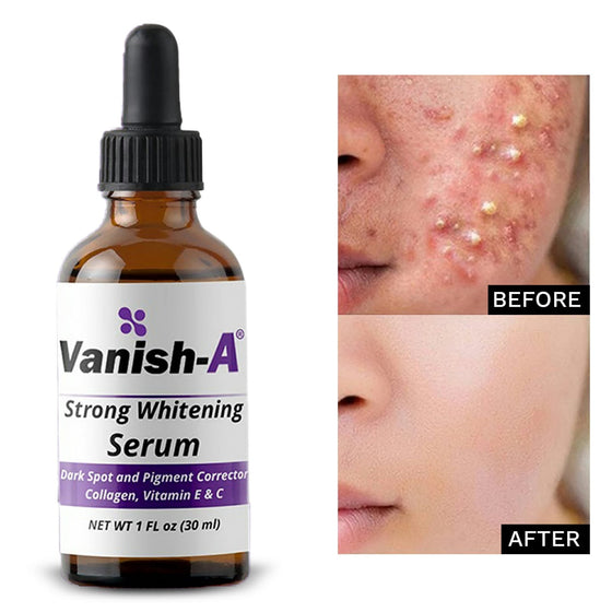 Vanish-A Strong Serum ( 1 fl oz )