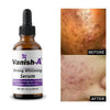Vanish-A Strong Serum ( 1 fl oz )