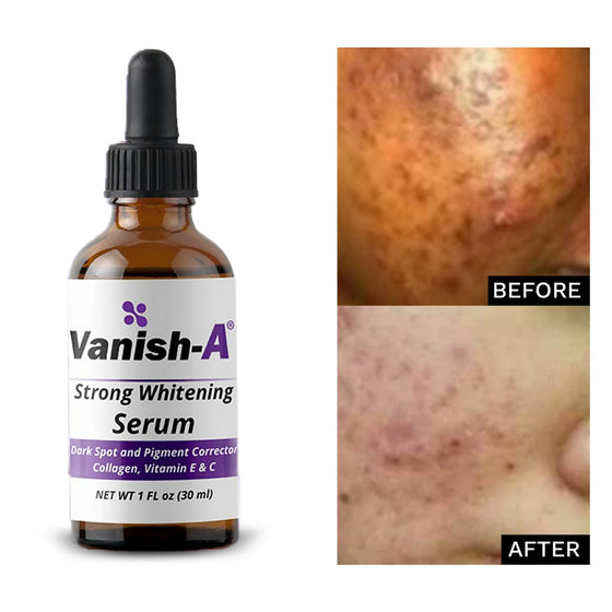 Vanish-A Strong Serum ( 1 fl oz )