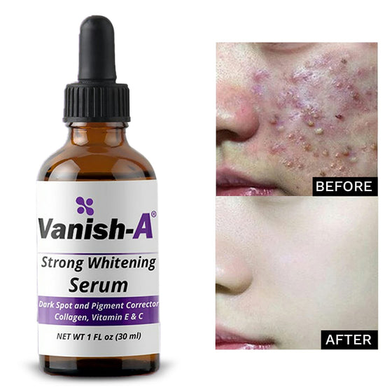 Vanish-A Strong Serum ( 1 fl oz )