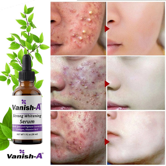 Vanish-A Strong Serum ( 1 fl oz )