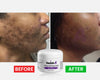 Vanish-A Strong Brightening Cream -2 oz