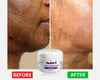 Vanish-A Strong Brightening Cream -2 oz
