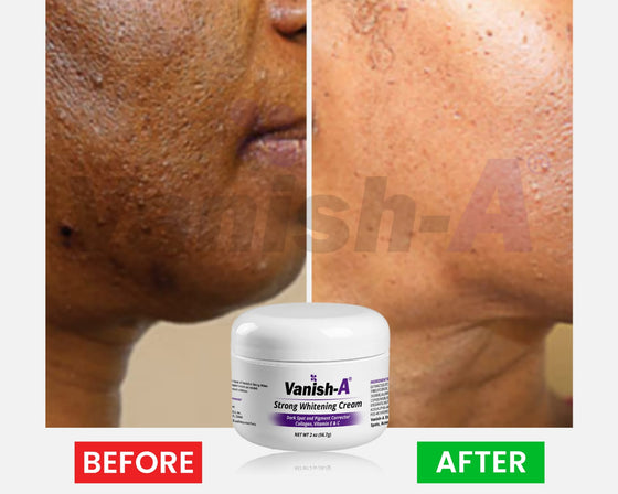 Vanish-A Strong Brightening Cream -2 oz