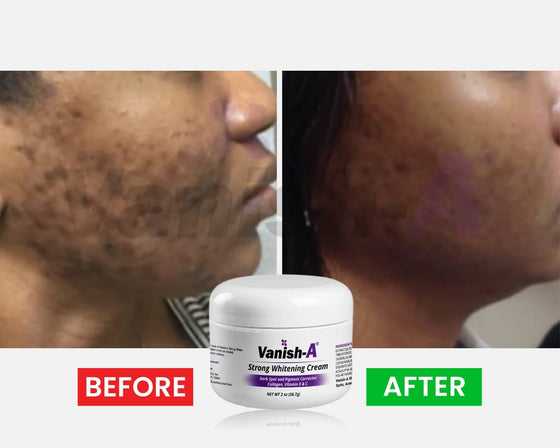 Vanish-A Strong Brightening Cream -2 oz