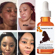  Turmeric Face Oil, Dark Spots Remover, Perfect Skin Glow